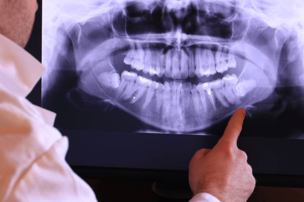 Best Emergency Tooth Extraction in Bear, DE